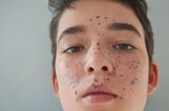 Benefits of hyaluronic acid for skin (Image via Pexels)